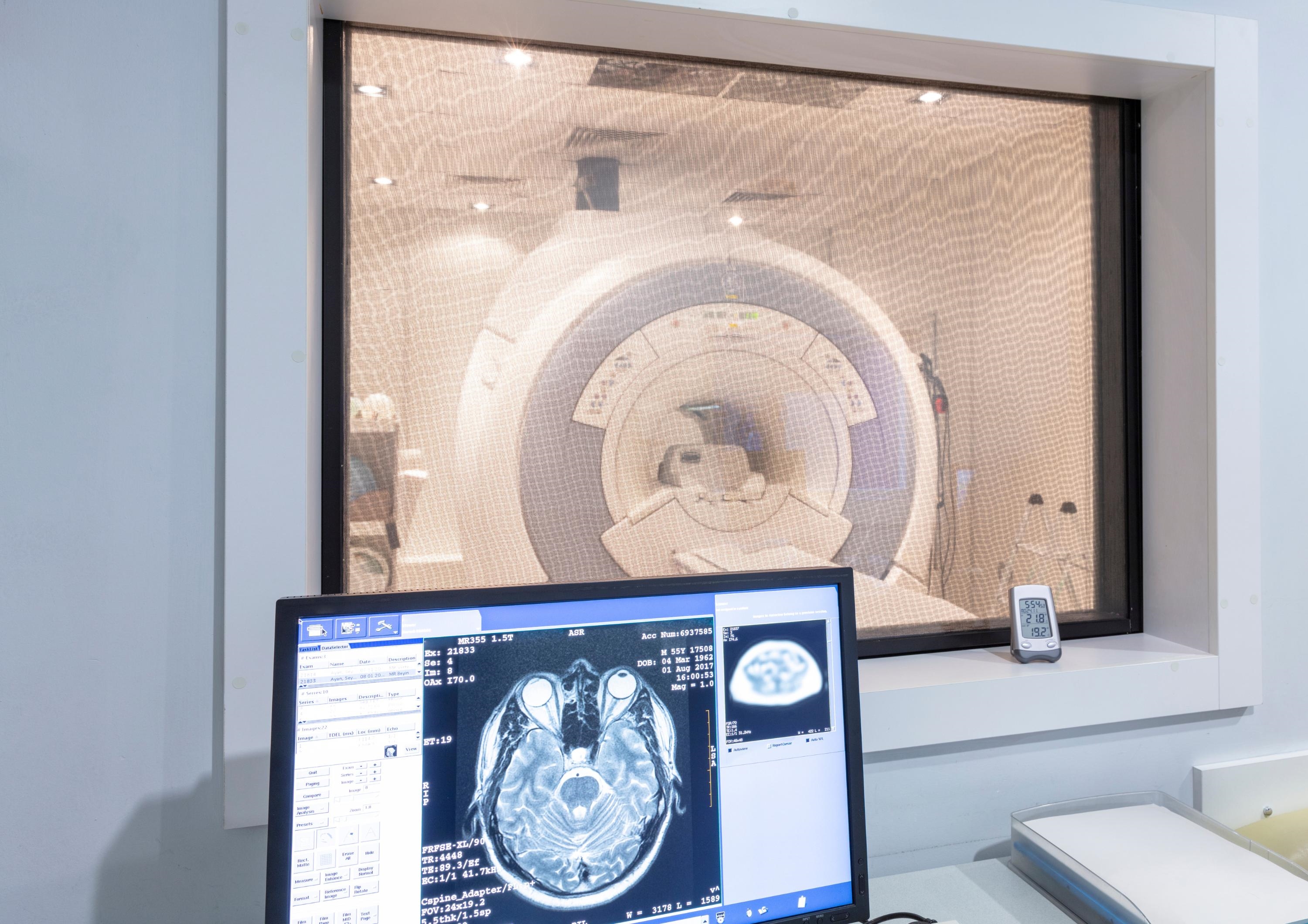 MRI and brain scan on a computer MRI and brain scan on a computer